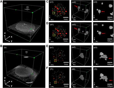 Automated detection and growth tracking of 3D bio-printed organoid clusters using optical coherence tomography with deep convolutional neural networks